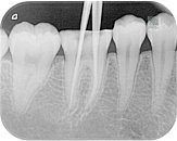 csm_endo2_2984c76793