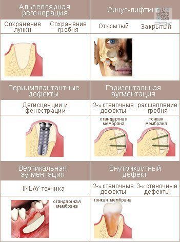 osteobiol_evolution_use