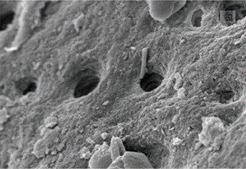 osteobiol_gen_os_microscope2
