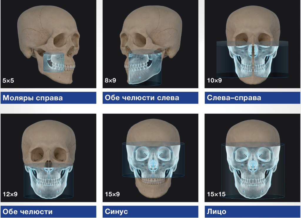 FOV_3x.png FOV_3x.png