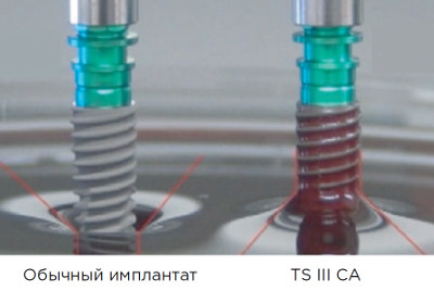 ts_ca_adv_1_1_200 - Copy 2.jpg