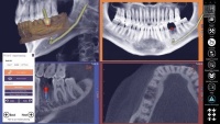 Модуль Exocad DICOM viewer. Средство просмотра DICOM файлов