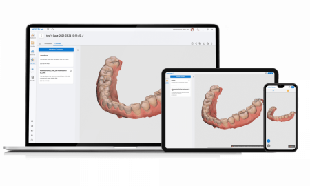 Medit i700 - высокоскоростной интраоральный сканер