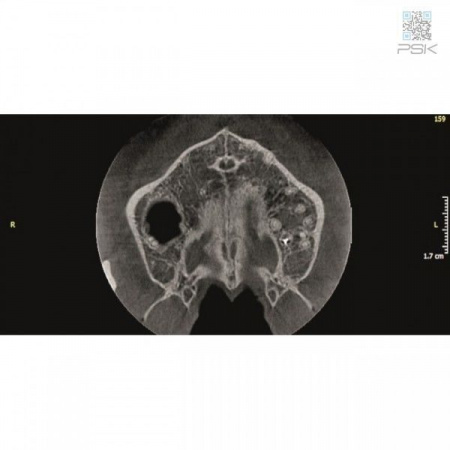 Ортопантомограф KaVo Pan eXam Plus 2D