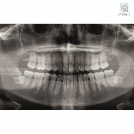 Ортопантомограф KaVo Pan eXam Plus 2D