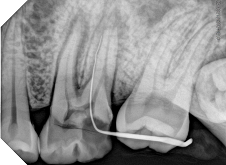 Интраоральный визиограф HDR 380
