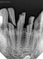 Интраоральный визиограф HDR 380