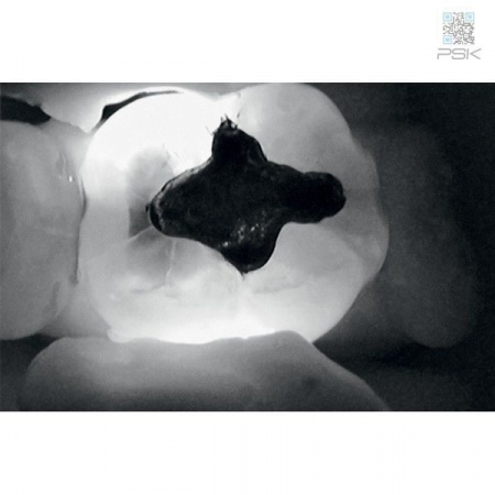 Прибор для диагностики кариозных поражений KaVo DIAGNOcam 2170 Прибор для диагностики кариозных поражений KaVo DIAGNOcam 2170