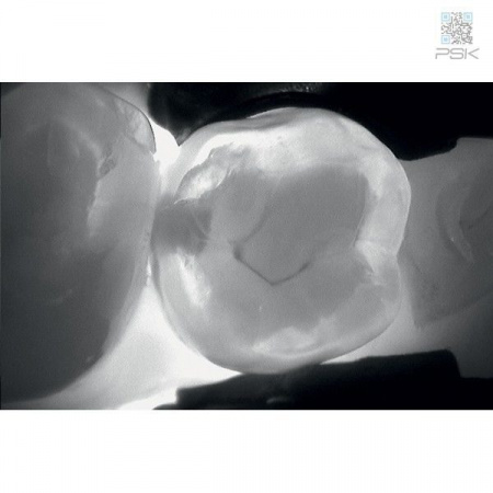 Прибор для диагностики кариозных поражений KaVo DIAGNOcam 2170 Прибор для диагностики кариозных поражений KaVo DIAGNOcam 2170