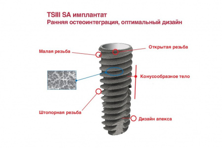Имлантат Osstem TS III SA Имлантат Osstem TS III SA