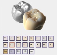 Модуль Exocad Trusmile. Модуль для естественной визуализации реставраций