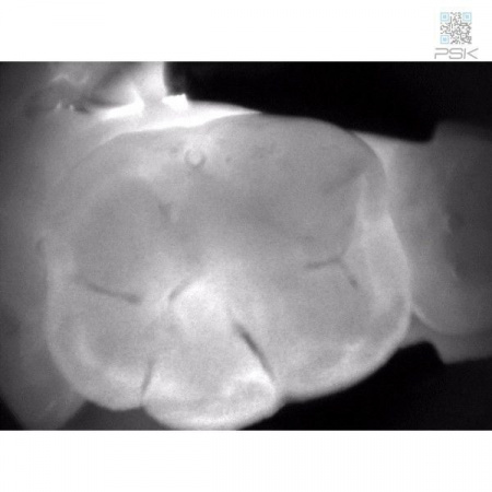 Прибор для диагностики кариозных поражений KaVo DIAGNOcam 2170 Прибор для диагностики кариозных поражений KaVo DIAGNOcam 2170