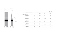 Набор Ridge split kit (offset) для расщепления гребня (изогнутый), OSSTEM Implant (Южная Корея)