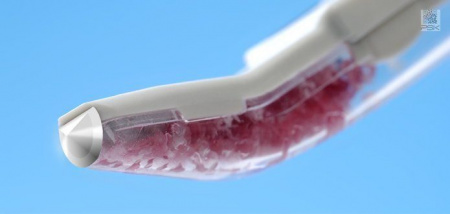 Костный скребок одноразовый - Safescraper Twist