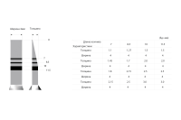 Набор Ridge split kit (straight) для расщепления гребня (прямой), OSSTEM Implant (Южная Корея)