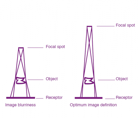 RXDC eXTend - высокочастотный настенный рентгеновский аппарат
