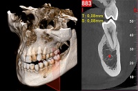Стоматологический томограф NewTom 2D/3D GO